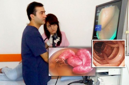 Məşhur həkimdən həyacan siqnalı