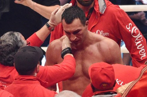 Kliçko dünya çempionu titulunu qoruya bilmədi