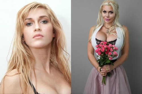 25 yaşlı qız o qədər estetik əməliyyat etdirdi ki...