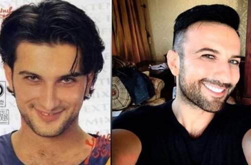 Gözəl gülmək üçün əməliyyat olunan ulduzlar