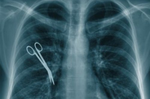 Həkimlərin dəhşətli səhvi 5 il sonra üzə çıxdı