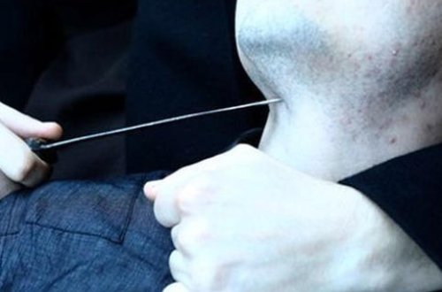 Bakıda kişinin başını küçədə kəsdilər