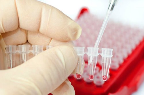 Azərbaycanda evlənmək istəyən 161 nəfərdə sifilis aşkarlandı