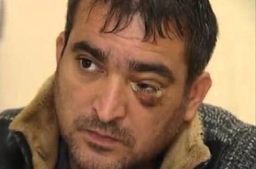 Dostunu bıçaqlayan şəxs: Kimə xoş olar bu hal?!