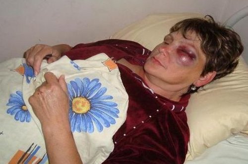 Bakıda 11-ci sinif şagirdi qadın müəllimini qana boyadı