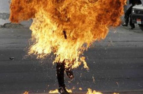 Bakıda ata olmağa hazırlaşan şəxs özünü yandırdı