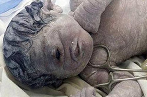 Misirdə təpəğöz uçaq doğuldu