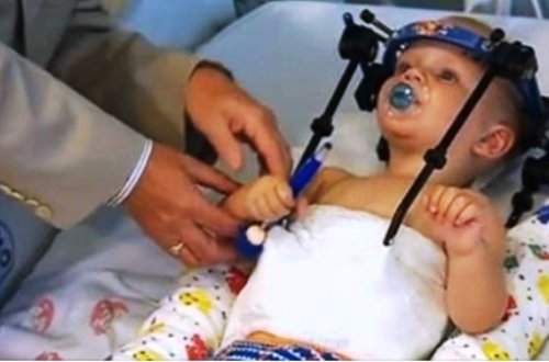 Başı bədənindən ayrılan körpə sağ qaldı