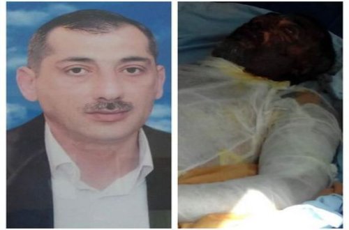 Qarabağ döyüşçüsü ANS-in həyətində niyə özünü yandırdı?