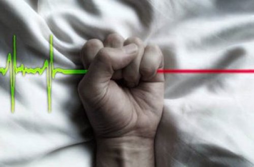 Həkimlər xəstələri öldürəcək