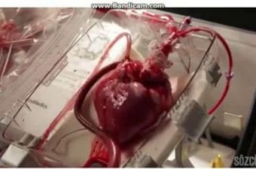 İnsan ürəyi belə işləyir, döyünür