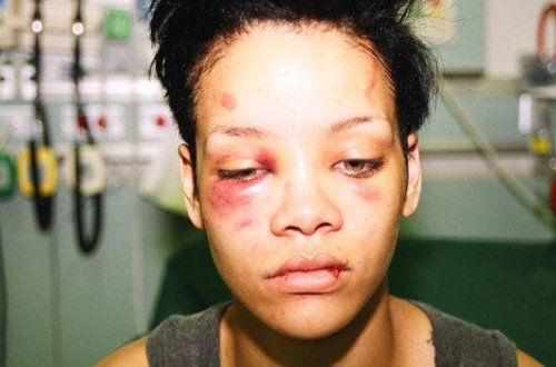 Rihannanı döydüyü üçün qadağa: 