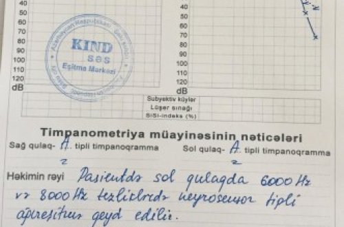 “KİND SƏS” EŞİTMƏ MƏRKƏZİNDƏ FIRILDAQ