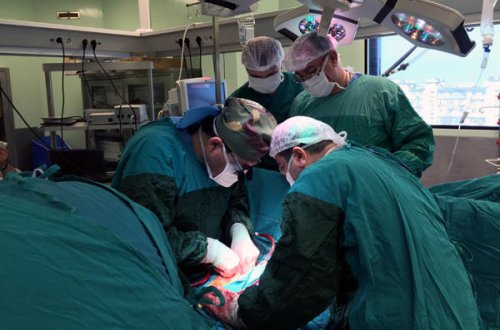 İnsan başının transplantasiyası üzrə ilk əməliyyat olacaq