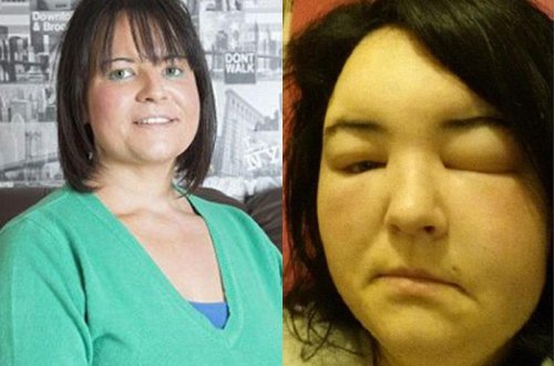 Saç boyası qadını xəstəxanalıq etdi