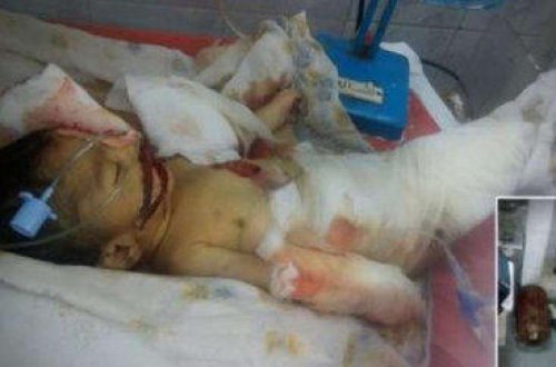 Siçanlar 10 günlük körpəni öldürdülər