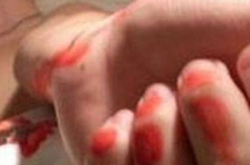 BAKIDA ŞOK OLAY: “Hilton”da 21 yaşlı qız damarlarını doğradı