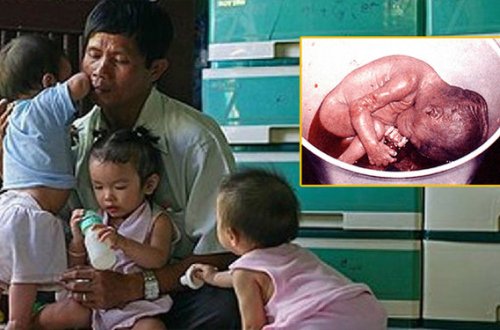 O, abort edilmiş uşaqların cəsədlərini klinikadan alır və...