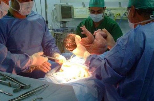 Lənkəran xəstəxanasında uşaq ölümü baş verib