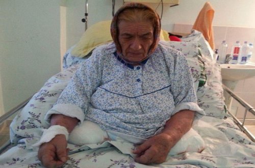 Xəstənin sağlam ayağını kəsən həkim və klinikanın direktoru işdən azad olundu