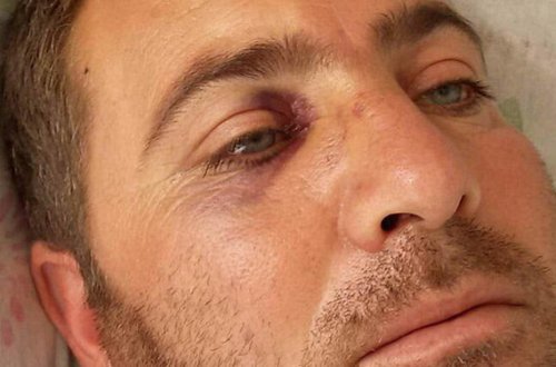 Tərtərdə köçkün ailələri arasında əlbəyaxa: