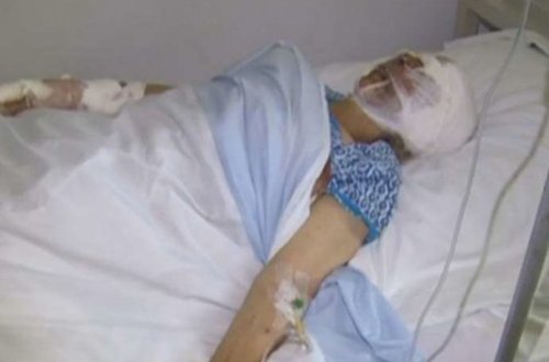 Çaqqallar 77 yaşlı qadına hücum etdi