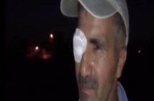 Çobana intim münasibət təklif edib pulunu oğurladılar