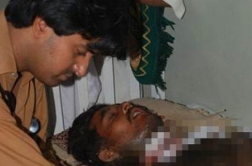 Evli qadın sevgilisini turşu ilə yandırdı