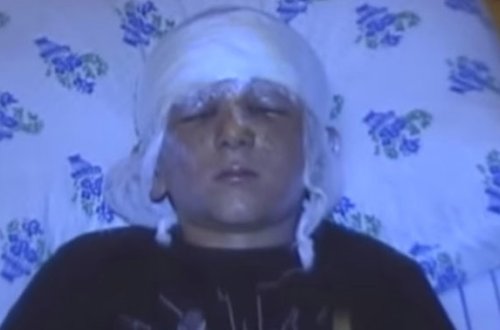 Tərtərdə hərbi sursat partladı, 8 yaşlı uşaq yaralandı