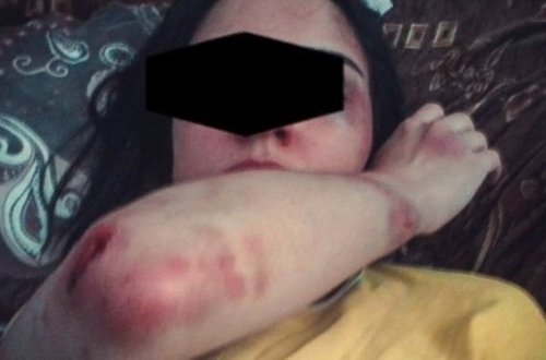 Hamilə qadını zorlayan, əlini ütü ilə yandıran şəxsə