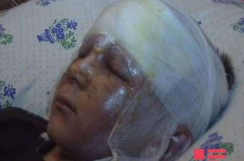 Tərtərdə partlayış: 8 yaşlı uşaq xəsarət alıb