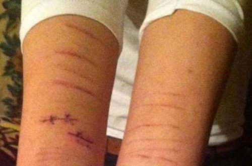 Bakıda polis idarəsində saxlanılan şəxs özünü doğrayıb