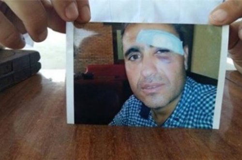 Sahibkarı döyən bələdiyyə sədri cəzalandırıldı