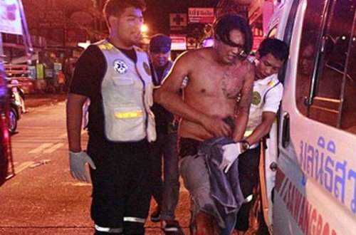 Xəyanət edən ərinin cinsiyyət orqanını kəsdi