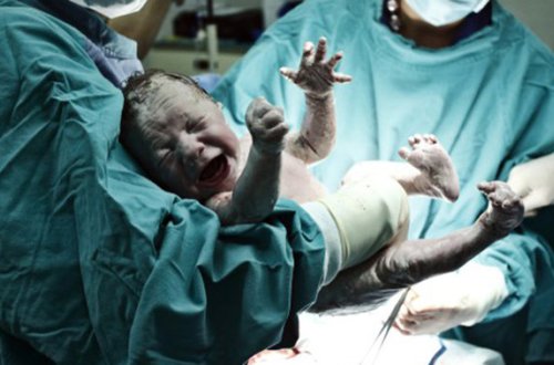 Bakıda məşhur klinikada həkim doğuş zamanı qaçıb?