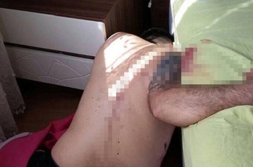 51 yaşlı kişi özünü niyə güllələyib öldürdü?