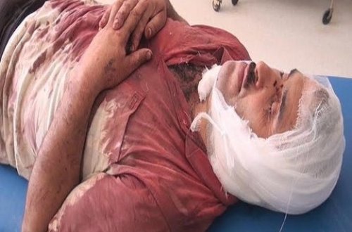 Lerikdə qulaqları kəsilən kişi ilə bağlı