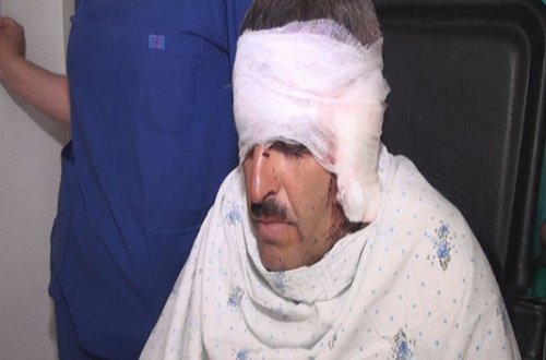 Qulaqlarını namus üstə belə kəsdilər