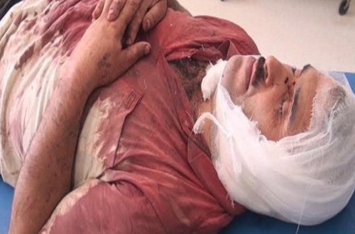 Lerik sakininin qulağını kəsən 2 nəfər saxlanılıb