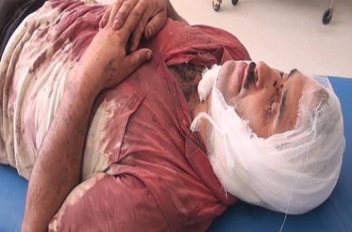 42 yaşlı kişinin qulağını niyə kəsdilər?