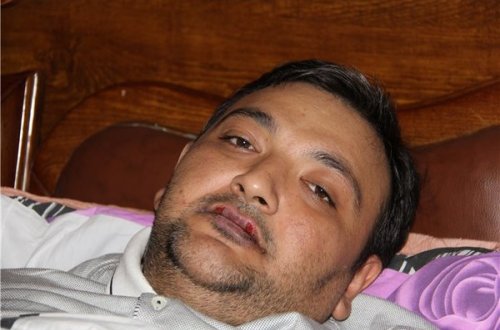 “Bilirəm, Prezident mənə kömək edəcək”