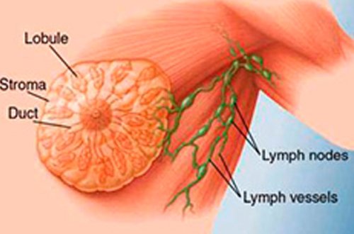 Alimlər döş xərçənginin yaranma səbəbini tapıblar