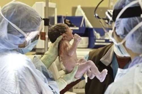 Doğuşu kişi həkimi etdi