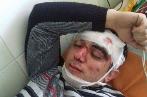 Lvovda ermənilərin yaraladığı azərbaycanlıların kimliyi məlum oldu