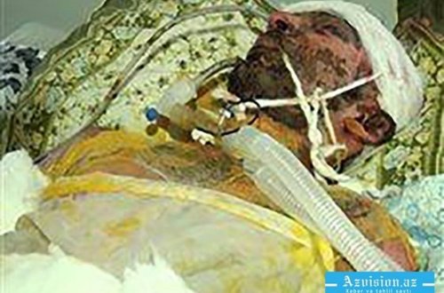 24 yaşlı oğlanı qız üstündə yandırıblar?