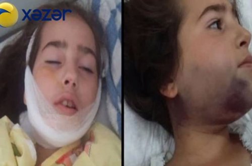 10 yaşlı uşağı 9-cu mərtəbədən atıblar - Bakıda+Video