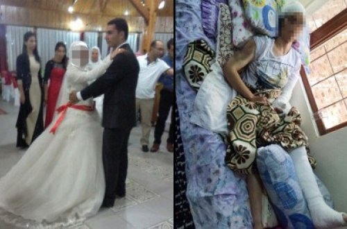 ŞOK! Təzə gəlinin dişlərini sındırıb ağzına ilan soxdular