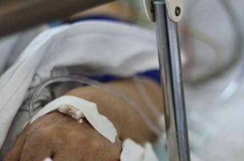 DƏHŞƏT! Qız sevgilisinin cinsiyyət orqanına 12 mismar sancdı - FOTO