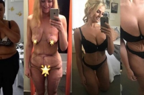 İnanılmaz dəyişim: bu qızın bədəni görənləri heyrətə gətirir - FOTOLAR