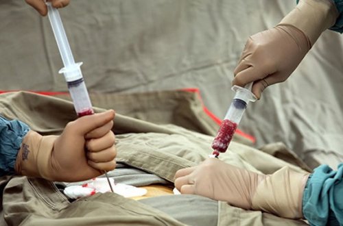 Azərbaycanda 24 nəfərə sümük iliyi köçürülüb